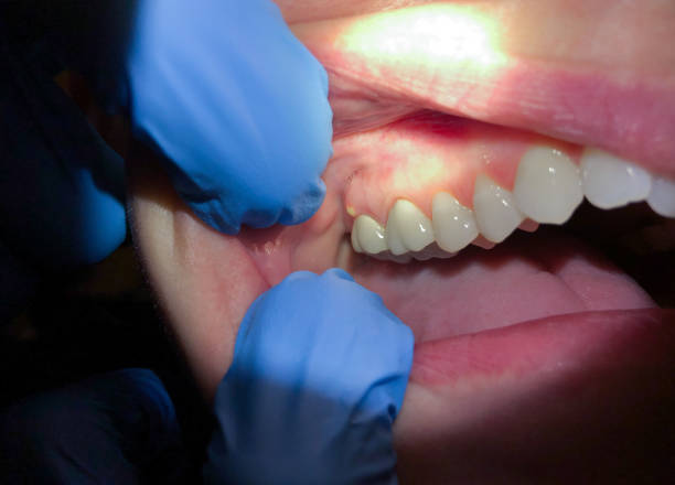 Best After-Hours Emergency Dentist in Mcloud, OK
